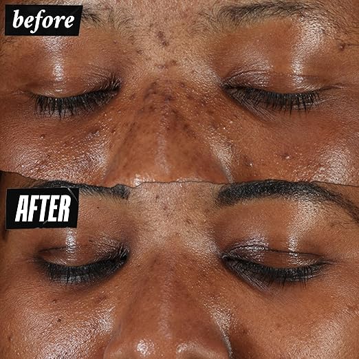 Kiehl's Clearly Corrective Dark Spot Serum