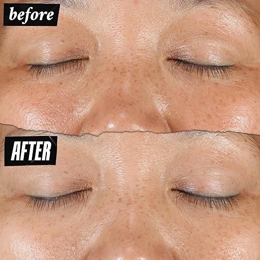 Kiehl's Clearly Corrective Dark Spot Serum