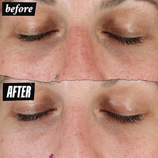 Kiehl's Clearly Corrective Dark Spot Serum