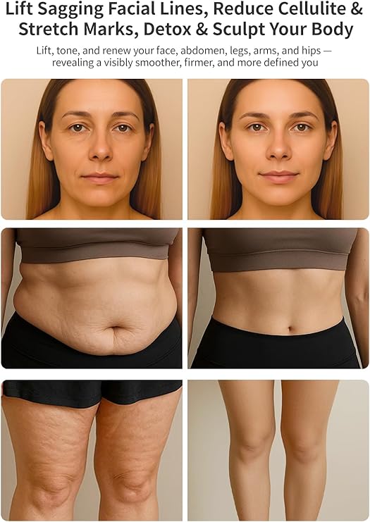 DiDEER 5-in-1 Body Sculpting Machine for Full-Body Contouring - Ephyra