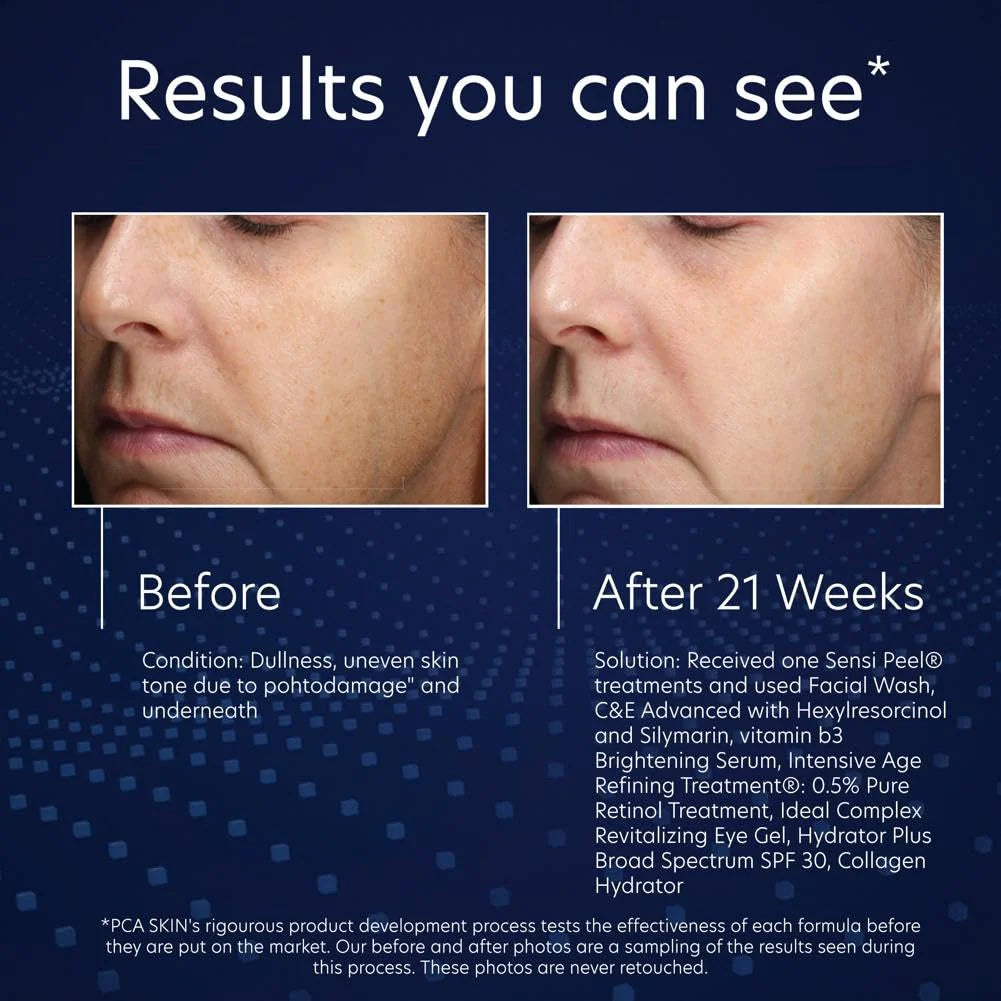 PCA SKIN Vitamin B3 Brightening Serum – 1.0 Pump - Ephyra