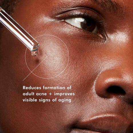 SkinCeuticals Blemish + Age Defense Serum - Ephyra