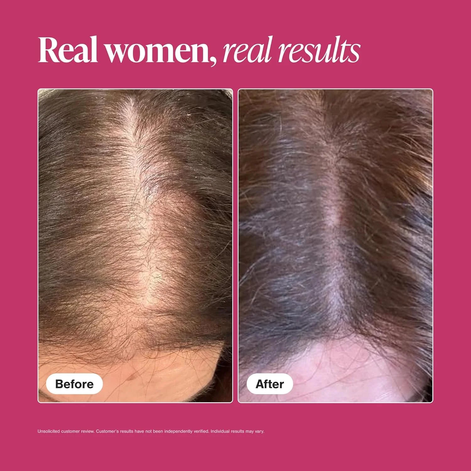 Before and after comparison of hair thickness on a pink background with text 'Real women, real results'.